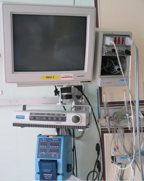 image of Marquette monitoring equipment donated by Brainwave