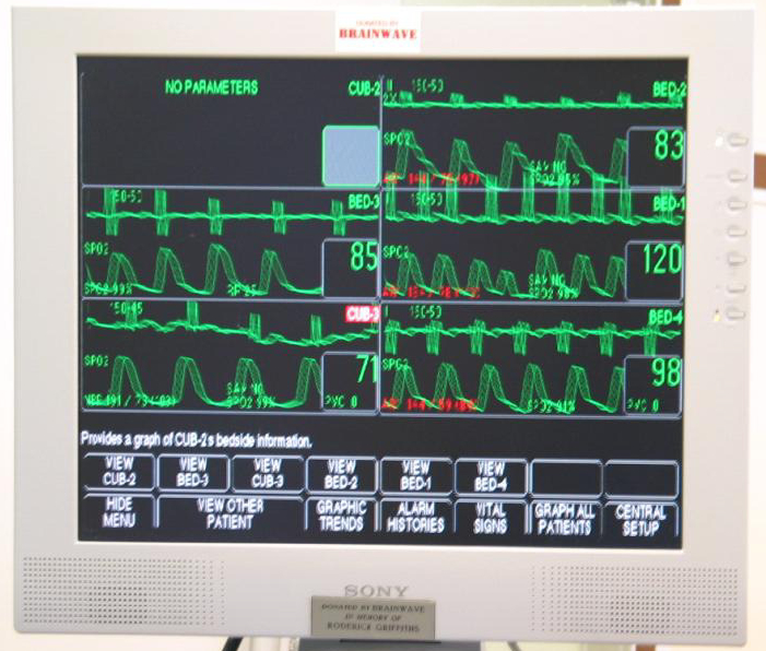 image of central nursing monitor to allow patient monitoring of multiple beds from a central console. Equipment donated by Brainwave in memory of Roderick Griffiths.